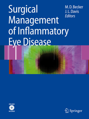 cover image of Surgical Management of Inflammatory Eye Disease